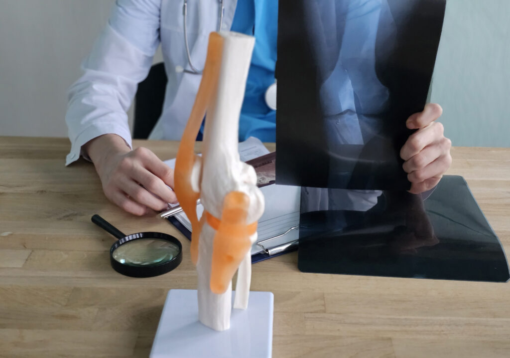 Fisioterapia traumatológica y tracción de columna